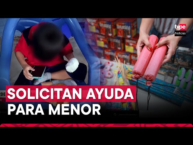 ⁣Piura: menor pierde cuatro dedos por manipular pirotécnico