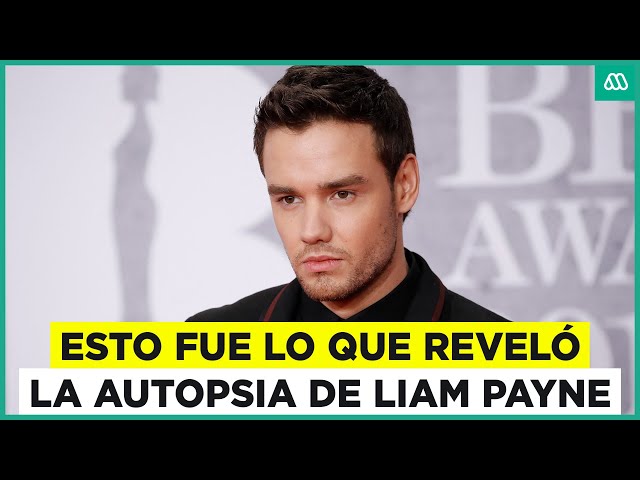 ⁣¿Qué reveló la autopsia de Liam Payne? Muere exintegrante de One Direction