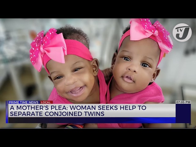 ⁣A Mother's Plea: Woman Seeks help to Separate Conjoined Twins | TVJ News