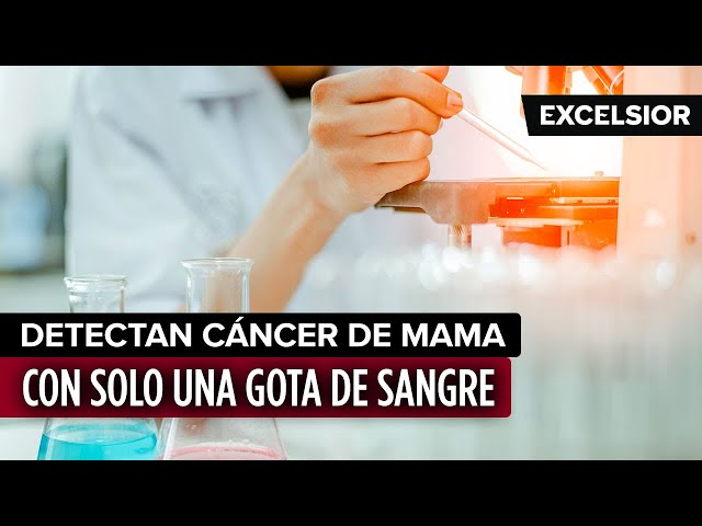 ⁣Detectan cáncer de mama con solo una gota de sangre