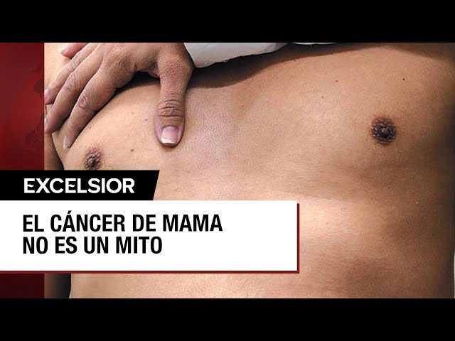 ⁣Cáncer de mama en hombres, una realidad que rompe mitos