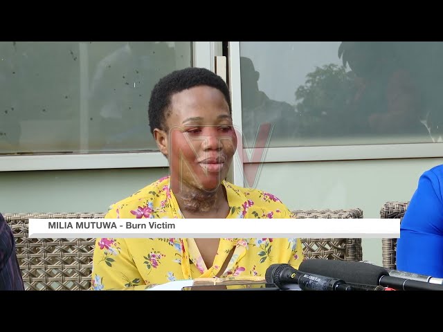 ⁣KCCA compensates woman injured while fleeing officers