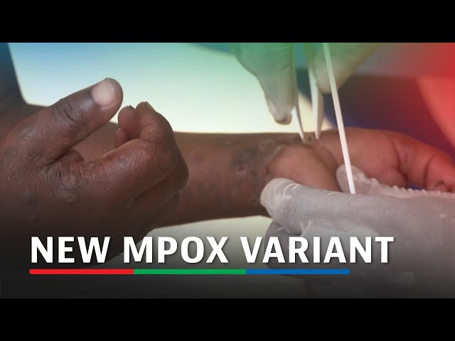 ⁣Germany identifies its first case of new mpox variant