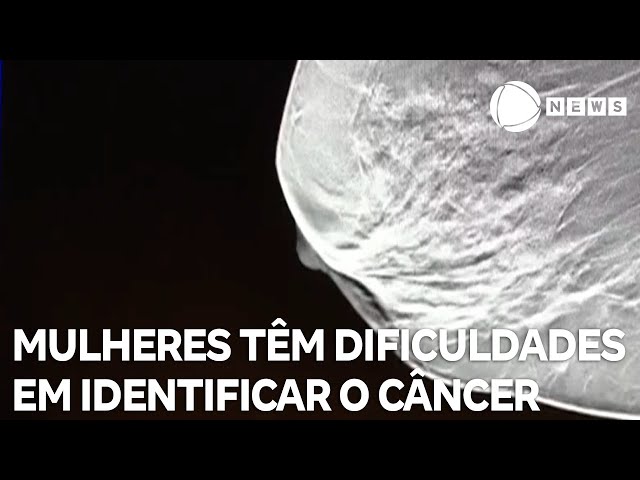 ⁣Mulheres têm dificuldades em identificar o câncer de mama