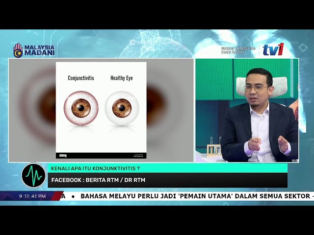 ⁣23 OKTOBER 2024 - DIARI RAWAT - KENALI APA ITU KONJUNKTIVITIS?