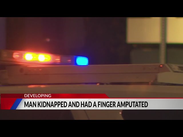 ⁣2 arrested for kidnapping, amputation of victim’s finger