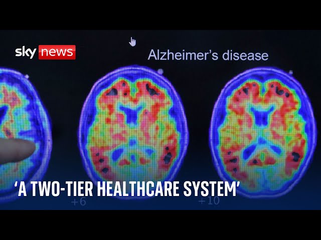 ⁣Pioneering Alzheimer's drug rejected for widespread use in NHS in England