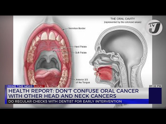 ⁣Health Report: Don't Confuse Oral Cancer with Other Head and Neck Cancers | TVJ News