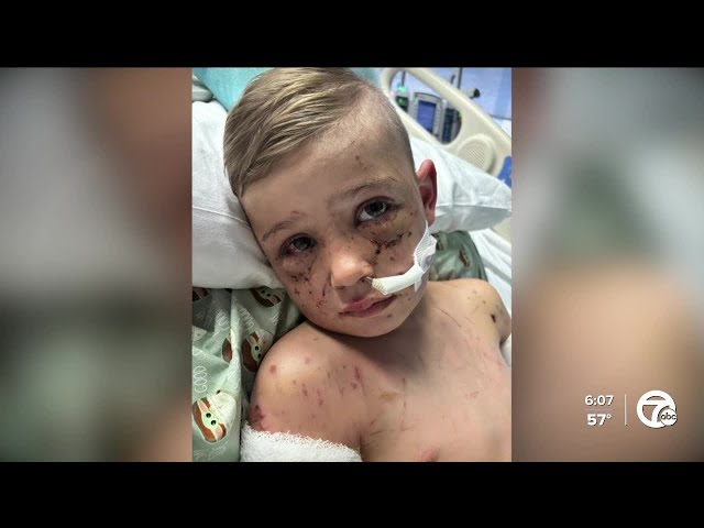 ⁣Boy with autism recovering, was mauled by dogs after entering neighbor's home