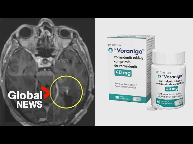 ⁣Oral brain cancer treatment approved by Health Canada