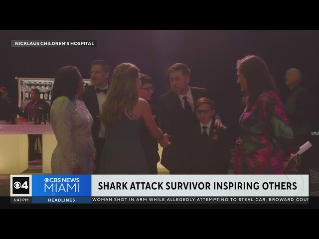 ⁣13-year-old shark attacker survivor returns to Nicklaus Children's Hospital to inspire others