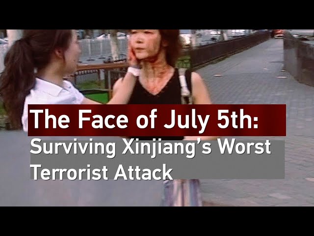 ⁣The Face of July 5th: Surviving Xinjiang's Worst Terrorist Attack