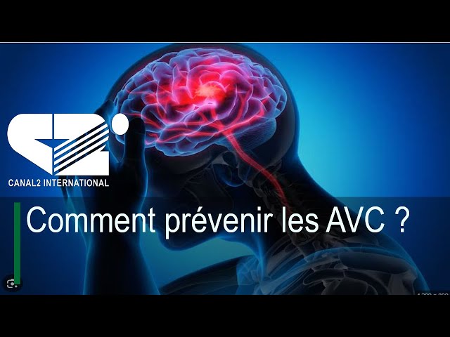 ⁣UN JOUR UN EVENEMENT - Comment prévenir les AVC ?