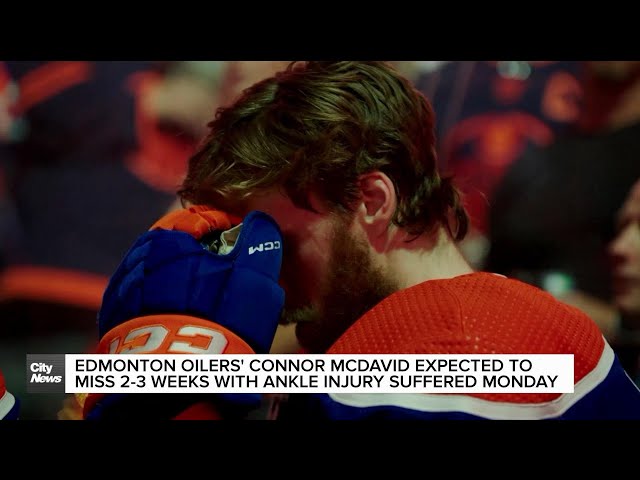 ⁣Oilers' Connor McDavid's injury sparks reaction from fans