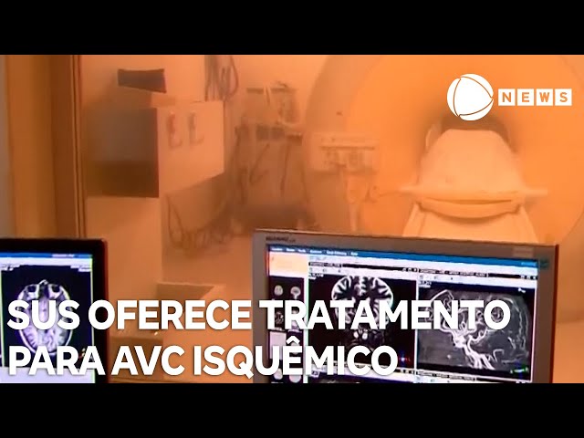 ⁣Tratamento para AVC isquêmico é oferecido no SUS