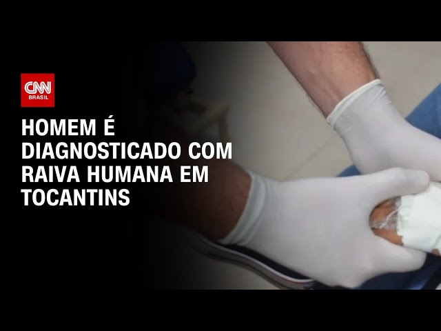 ⁣Homem é diagnosticado com raiva humana em Tocantins | AGORA CNN