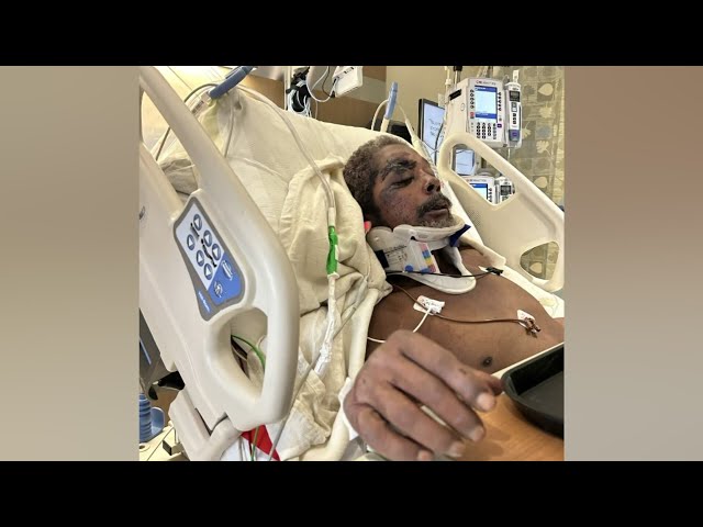 ⁣Aurora father hospitalized after weekend hit-and-run crash