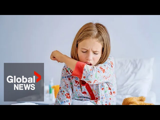 ⁣Walking pneumonia cases spike in parts of Canada, particularly among kids