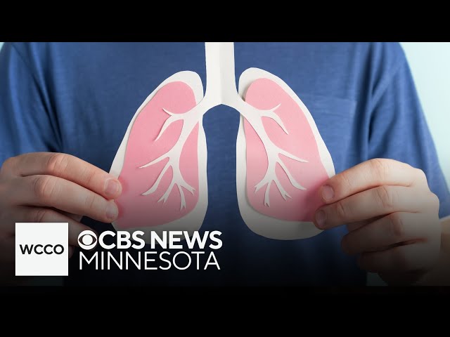 ⁣CDC warns about recent increase in "walking pneumonia" amongst children