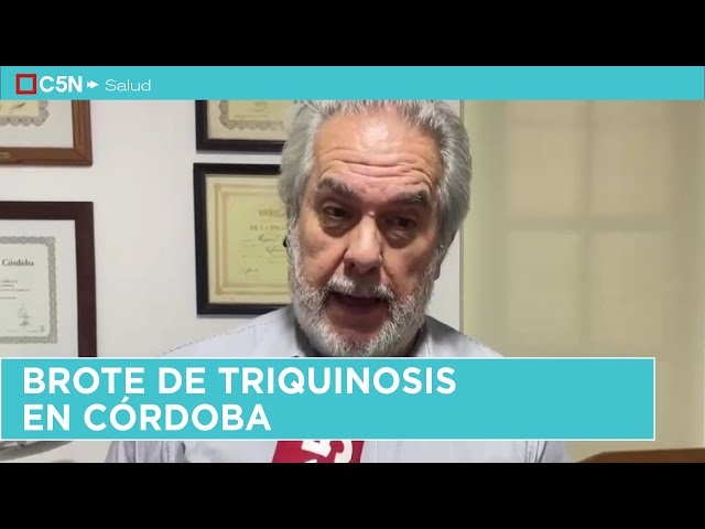 ⁣BROTE DE TRIQUINOSIS EN CÓRDOBA: HAY TRES PERSONAS INTERNADAS