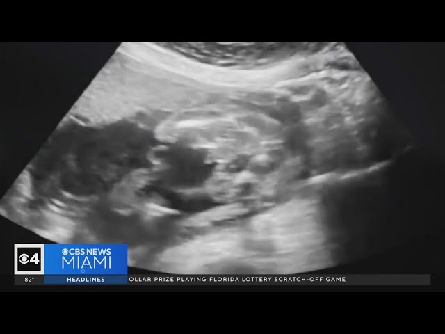 ⁣What does the future of abortion look like in Florida after voters rejected Amendment 4?