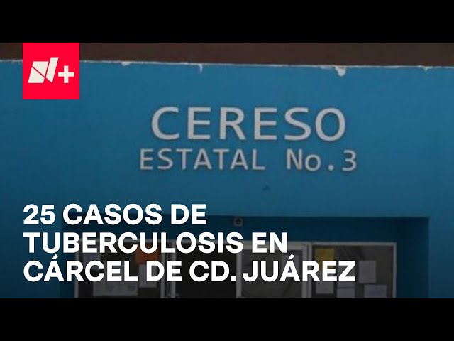 ⁣Contagio masivo de tuberculosis en reos del Cereso de Juárez, Chihuahua - En Punto