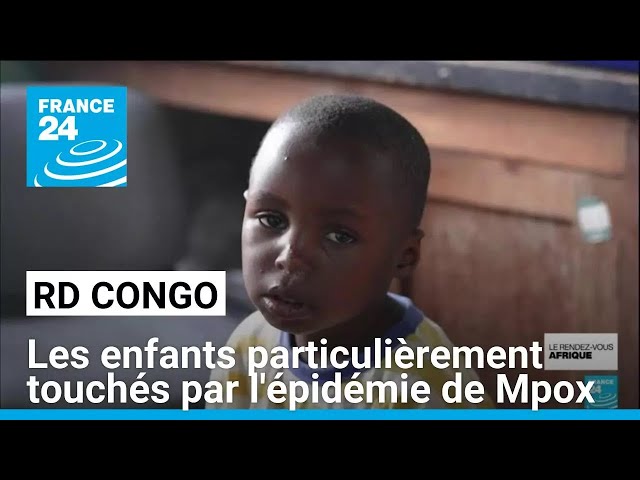 ⁣RD Congo : les enfants particulièrement touchés par l'épidémie de Mpox • FRANCE 24