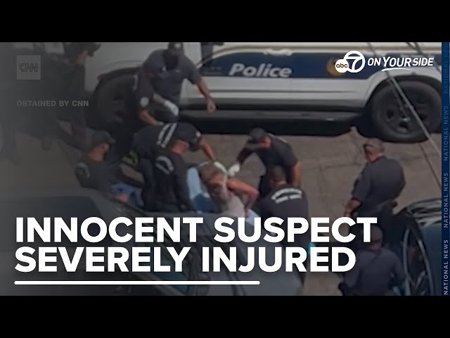 ⁣Video shows man suffer third degree burns during Phoenix arrest