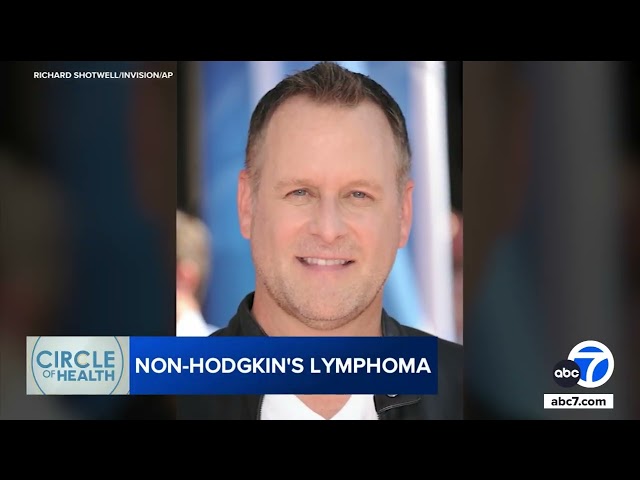 ⁣'Full House' star Dave Coulier diagnosed with non-Hodgkin lymphoma. What to know about the