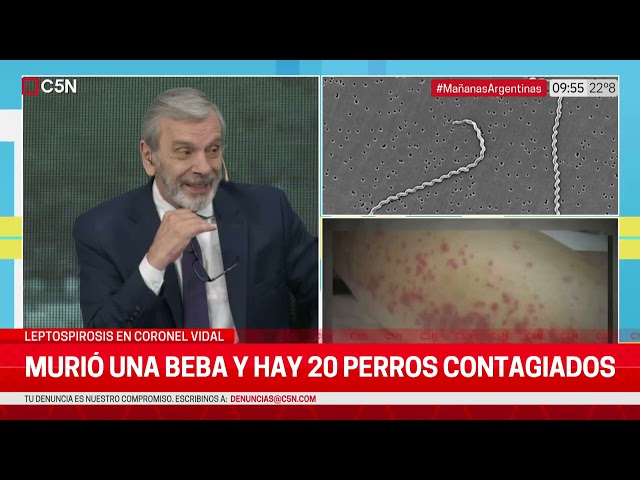 ⁣LEPTOSPIROSIS en CORONEL VIDAL: MURIÓ una BEBA y HAY 20 PERROS CONTAGIADOS