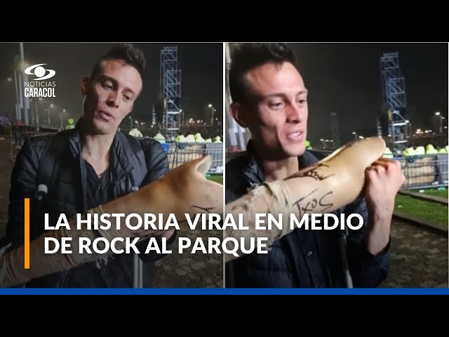 ⁣Una historia viral: Mago de Oz autografió prótesis de un fan en Rock al Parque