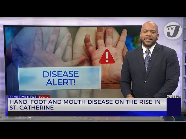 ⁣Hand, Foot & Mouth Disease on the Rise in St. Catherine | TVJ News