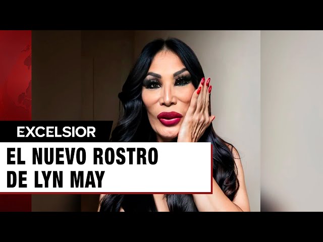 ⁣Lyn May impacta con nuevo rostro ¡Así reaccionan las redes!