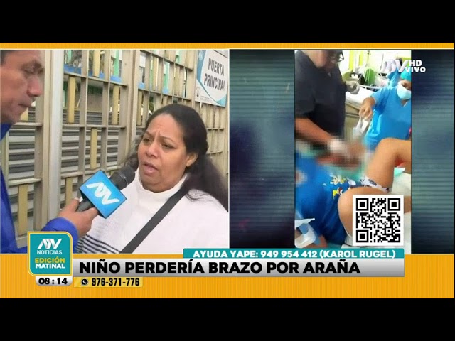 ⁣Madre clama por ayuda por hijo que fue mordido por una araña