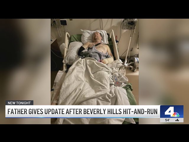 ⁣Father hurt in carjacking in Beverly Hills shares update about health