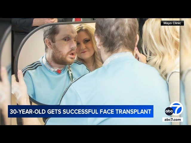 ⁣Man receives face transplant decade after shooting himself in the face