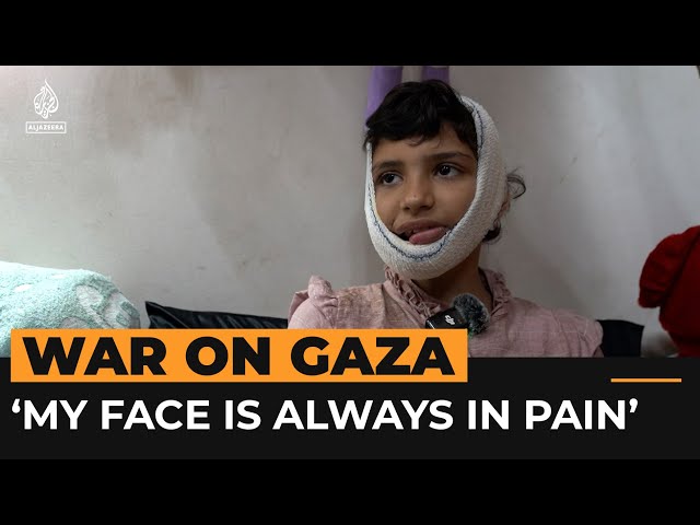 ⁣Severe injuries change 12-year-old Mazyouna’s life in Gaza