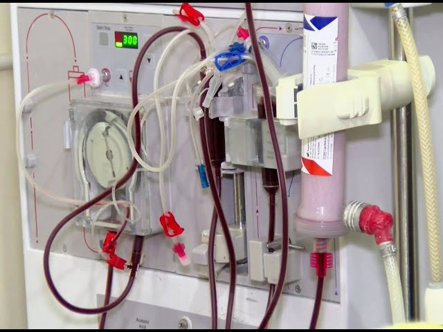 ⁣KATH to install seven new dialysis machines by end of November