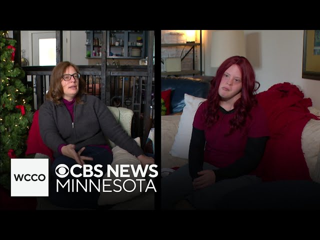 ⁣After traumatic brain injury, Orono woman finds way to move forward and inspire others