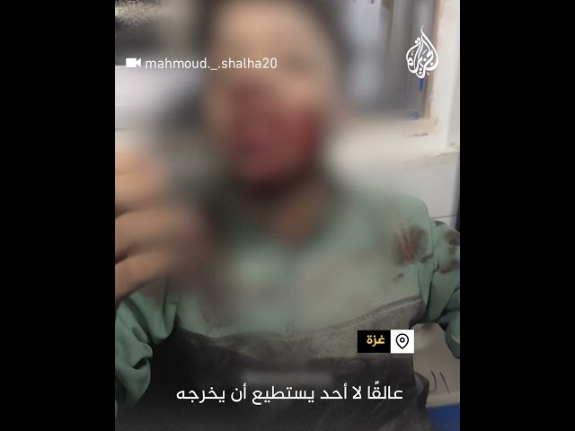 ⁣"العالم لا يشعر بنا".. صرخة طفل من غزة أصيب جراء القصف الإسرائيلي