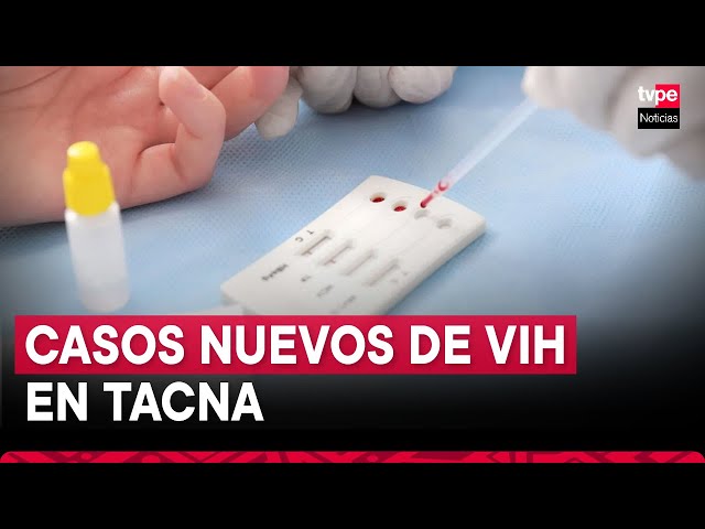 ⁣Se han registrado alrededor de 130 nuevos casos de VIH en lo que va de año en Tacna