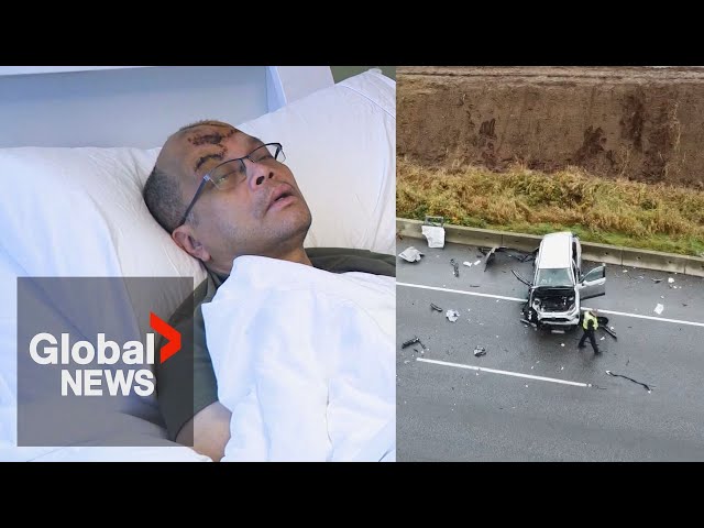 ⁣Doctor-turned-Uber driver hit by car while helping victims of highway crash in BC