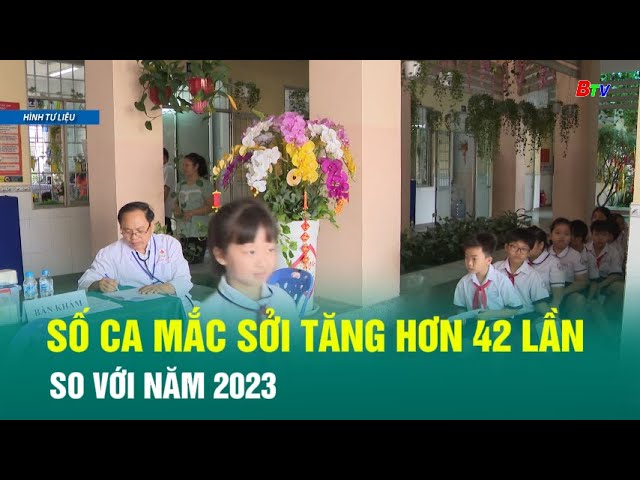 ⁣Số ca mắc sởi tăng hơn 42 lần so với năm 2023