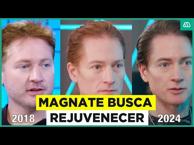 ⁣El costoso tratamiento de magnate para rejuvenecer