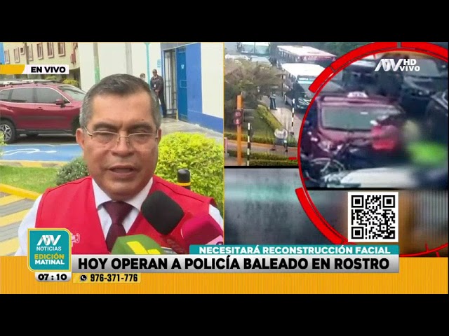 ⁣Policía baleado en la cabeza será operado hoy: "Necesita una reconstrucción facial"