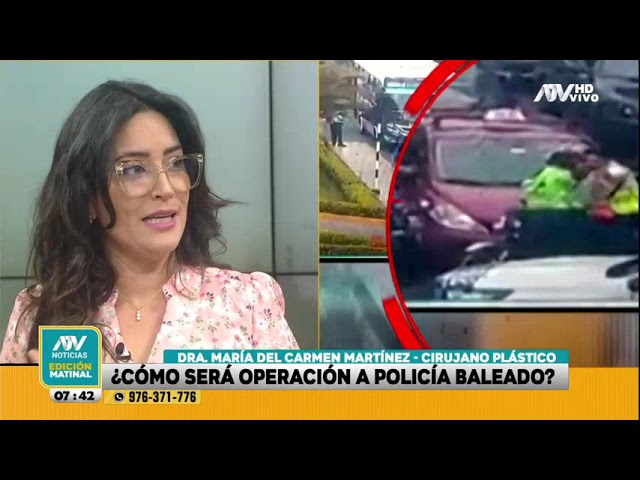 ⁣Policía baleado: Cirujana plástica explica cómo será la reconstrucción facial