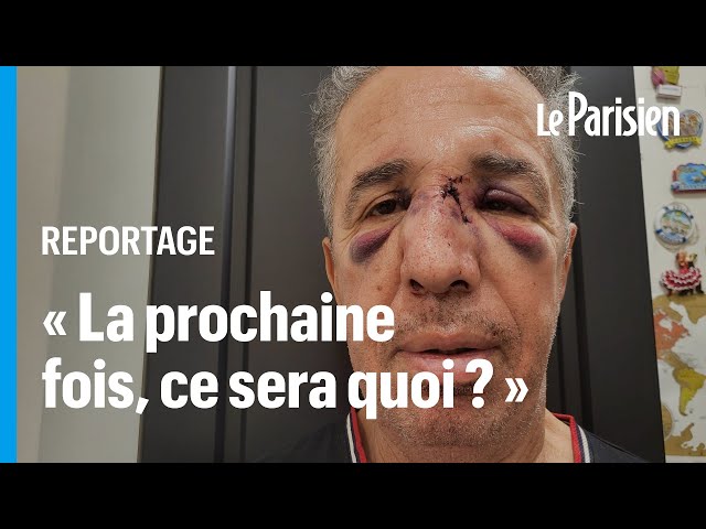 ⁣Agressé violemment par un patient, ce médecin songe à fermer son cabinet