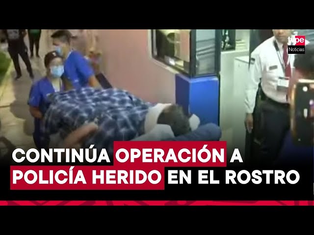 ⁣Intervienen quirúrgicamente a policía herido en el rostro por intentar frustrar asalto en San Borja