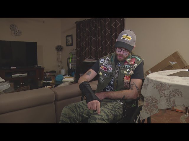 ⁣Colorado motorcyclist and U.S. Army veteran struggles after hit-and-run