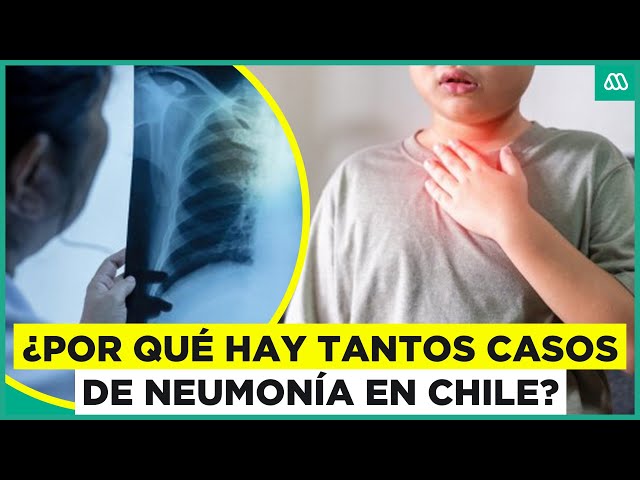 ⁣Análisis del Aumento de Casos de Neumonía por Mycoplasma en Chile